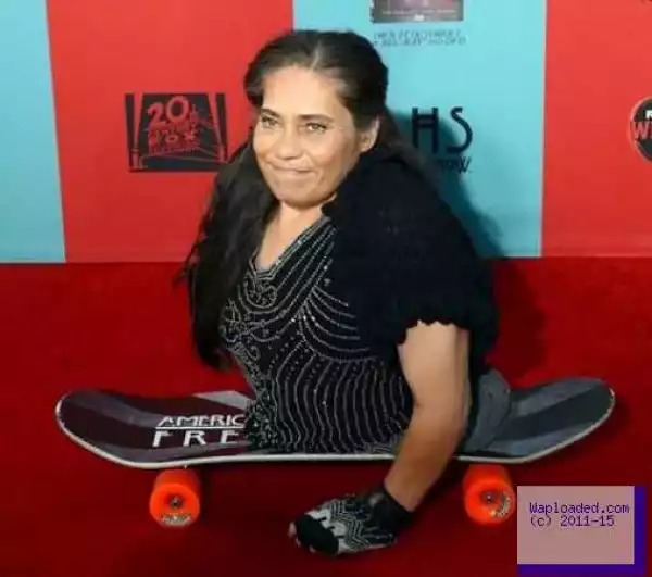 US woman with half a body and actress Rose Siggins dies at 43